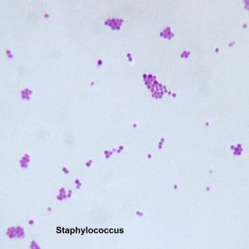 Staphylococcus smear