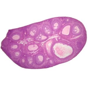 rabbit mature ovary sec.