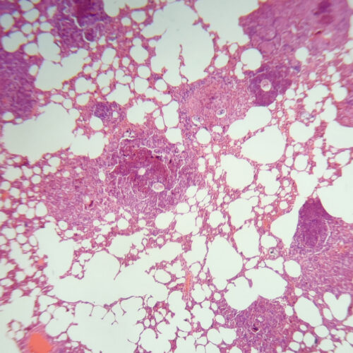 1set life cycle of schistosoma japonicum prepared microscope slides - Image 6