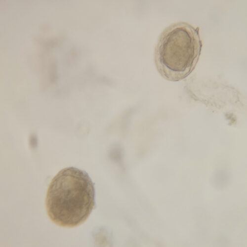 1set life cycle of schistosoma japonicum prepared microscope slides - Image 7