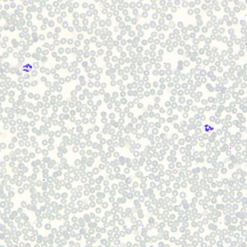 human blood smear Giemsa Stain 40X