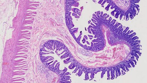 Human Duodenum section, H.E. Stained