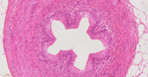 Human Ureter cross-section histology slides, 7 µm sec., H&E Stain