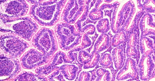 Human ileum cross-section histology slides