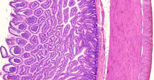 Human ileum cross-section histology slides, 7 µm sec., H&E Stain