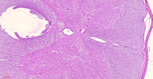 Human spinal cord cross-section histology slides