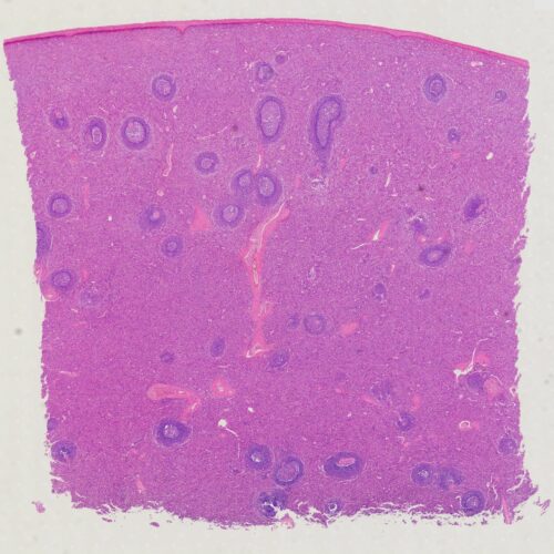 Human spleen Section human histology prepared microscope slides