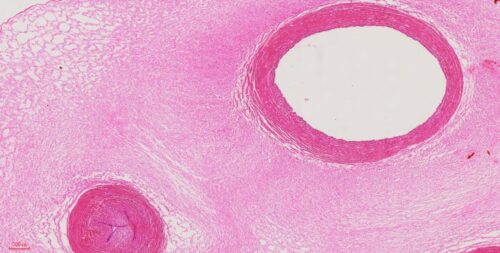Mucous tissue, Umbilical cord of Fetus t.s., 7 µm sec.