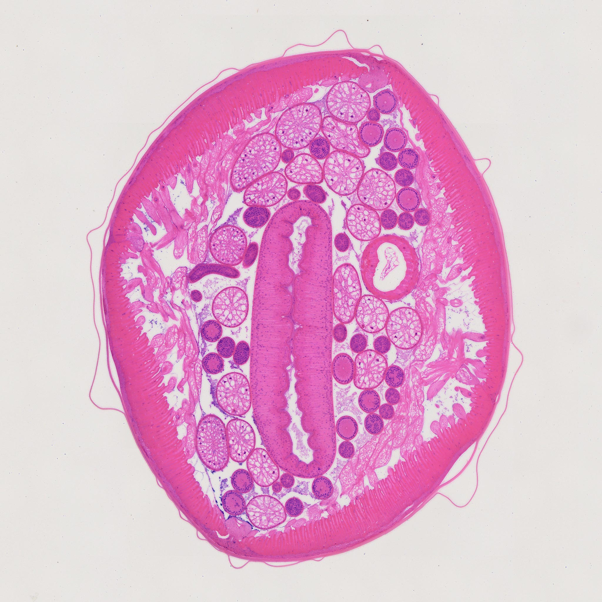 1pc male Ascaris lumbricoides or Roundworm, 7 µm sec., H&E Stain,  Parasitology slides wholesale supplier