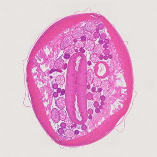 male Ascaris lumbricoides or Roundworm, 7 µm sec.