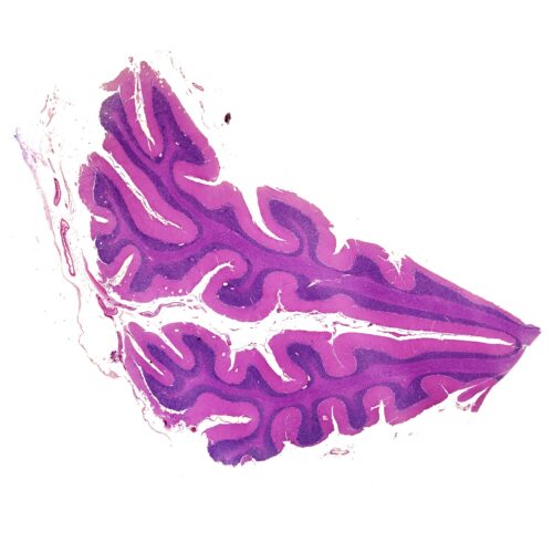 Human Cerebellum H.E. Stain