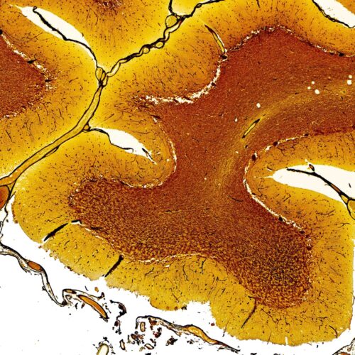 Human Cerebellum silver stain