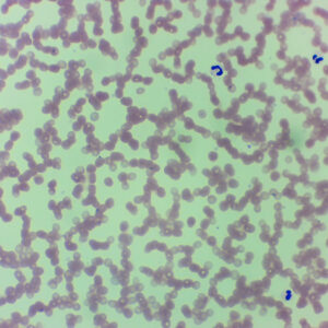 Plasmodium Vivax