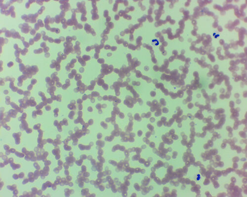 Plasmodium Vivax