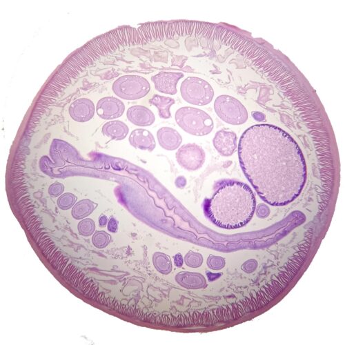 female Ascaris lumbricoides or Roundworm, 7 µm sec.