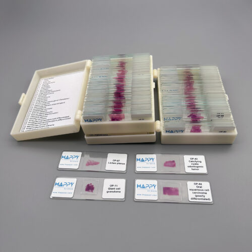 60pcs Human Oral Pathology Slides, Oral Pathology Histology Prepared Microscope Slides - Image 2