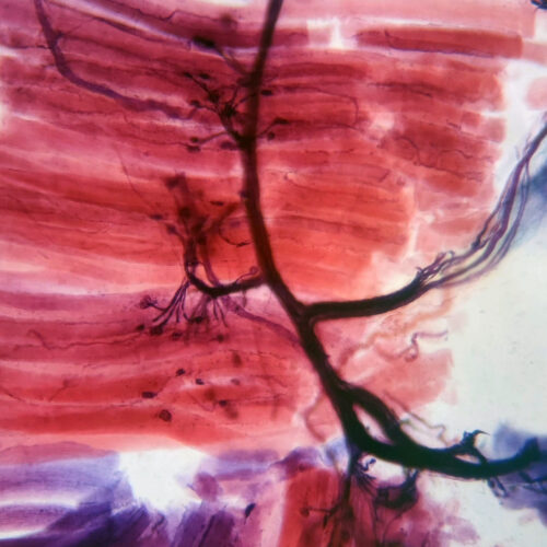 Motor nerve ending