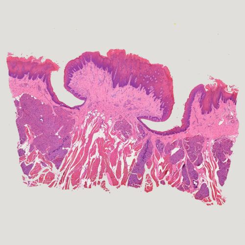 circumvallate papilla