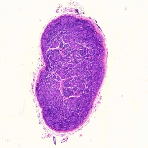 Dorsal root ganglion cross section, spinal ganglion