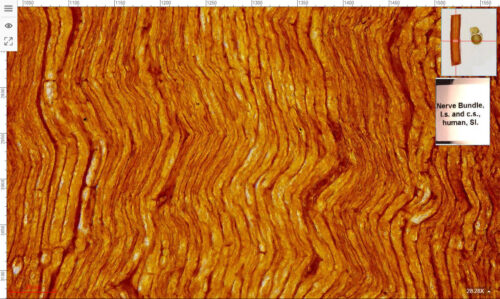 1pcs Human nerve bundle l.s. and c.s. one same slide, 7 µm sec., Silver Stain - Image 3