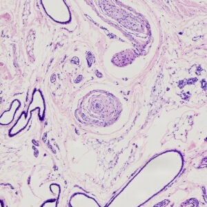 Pacinian corpuscle