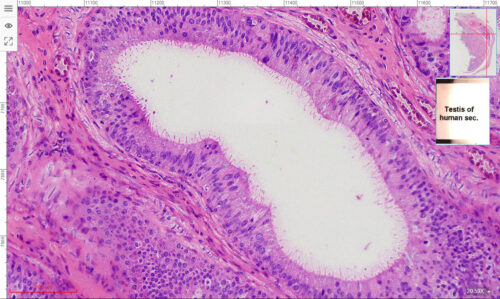 1pcs testicle or testis, section of human male reproductive gland, H.E. Stained - Image 2
