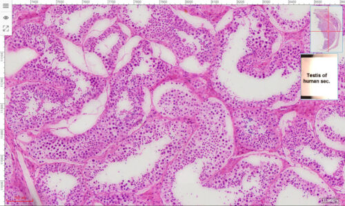 Testicle or testis of human section H.E. stain