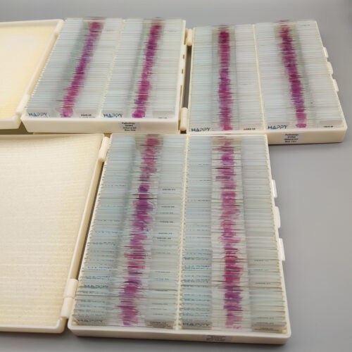 300pcs human pathology microscope slides, large human pathology slides set, Factory Outlets - Image 3
