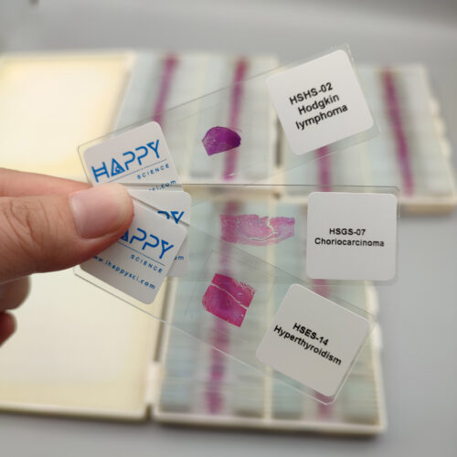 300pcs human pathology microscope slides, large human pathology slides set, Factory Outlets - Image 2