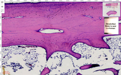 Decalcified Compact bone Longitudinal section