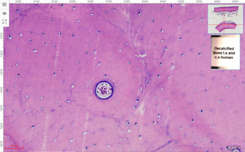 Decalcified-Compact-bone-cross-section