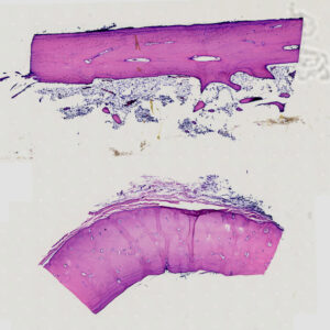 Decalcified-Compact-bone