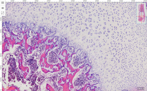 Fetus Joint show Endochondral Bone Development 20X