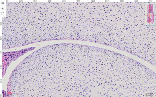 Fetus Joint showing Endochondral Bone Development