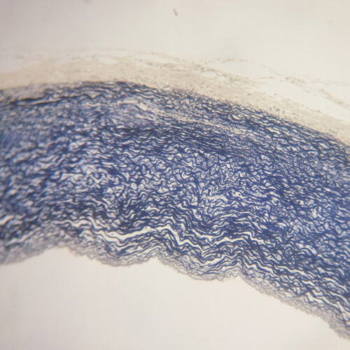 Artery Elastic Fibers Stain 10X