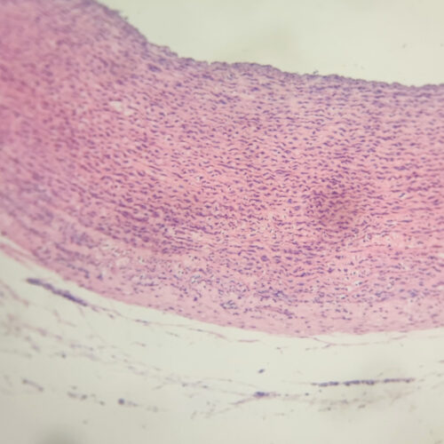 Artery H.E. Stain 10X