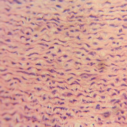 Artery H.E. Stain 40X