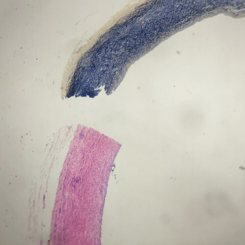 Comparison of Artery H.E. Stain and Elastic Fibers Stain