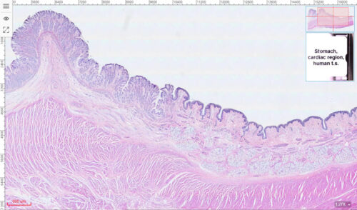 Esophagus and stomach junction