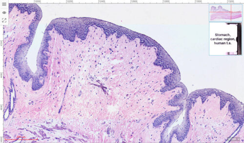 Human Cardia Esophagus part