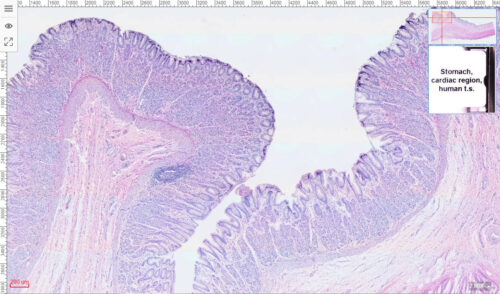 Human Cardia of stomach part