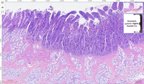 Human stomach pyloruss duodenum