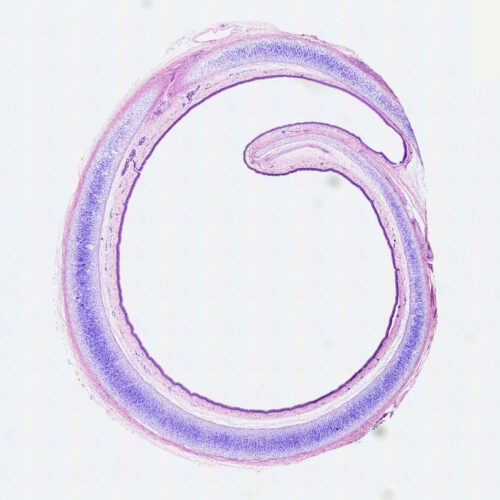 Pseudostratified ciliated columnar epithelium