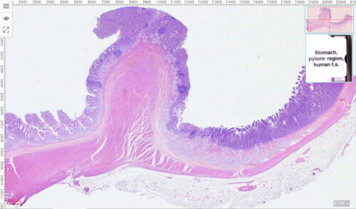 1pcs Human stomach pylorus section H.E. stain, Stomach and duodenum junction - Image 4