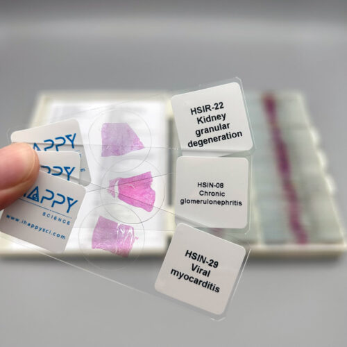 Advanced 120pcs Human Histopathology Slides wholesale, University Standard, Factory Outlets - Image 2