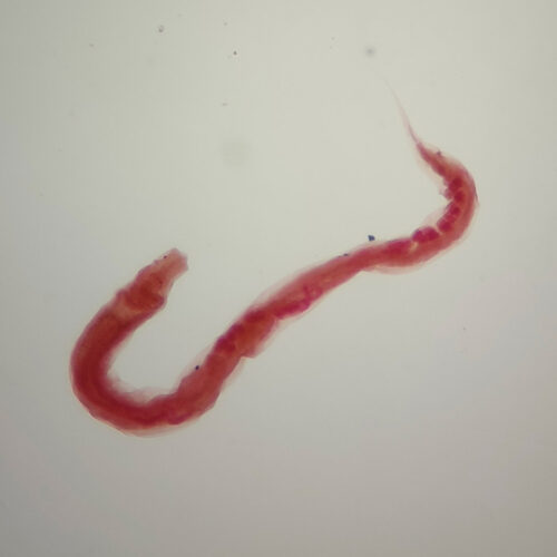Enterobius vermicularis male