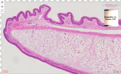 Human Epiglottis