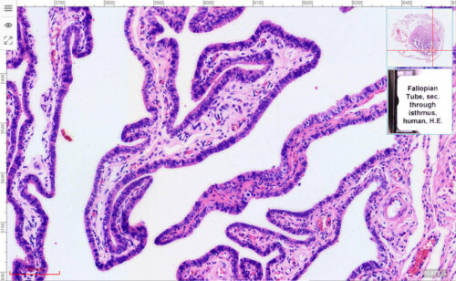 Human Fallopian tube, 7 µm sec., H.E. stain