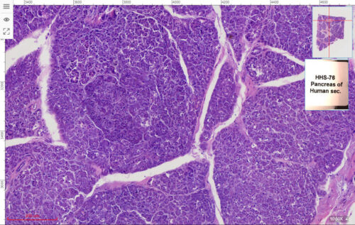 Human Pancreas show pancreatic islet Micro View