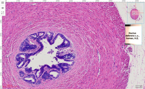 vas deferens or ductus deferens